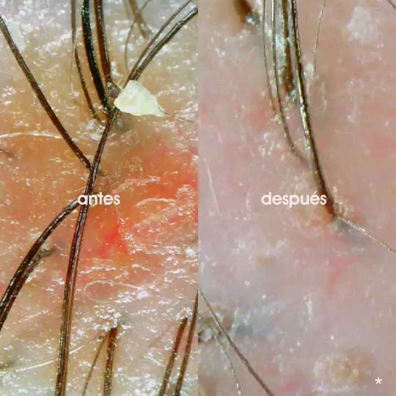 Miriamquevedo Black Baccara Cellular Breathing Hair Multiplying Scrub Scalp Mask 200ml